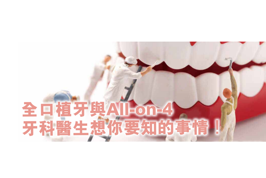 全口植牙與All-on-4 牙科醫生想你要知的事情！